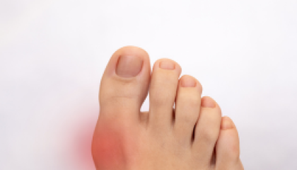 肉類與海鮮增加痛風機率_cover